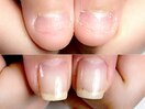 深爪解消♪自爪育成クリア仕上げ