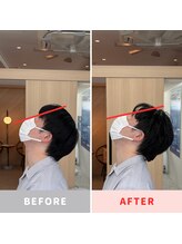 きっと整体院/30代男性　頭痛整体