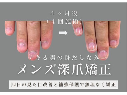 ヴェールリム(verl lim)の写真