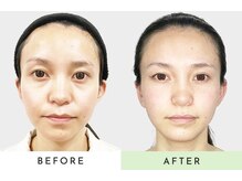 小顔矯正と姿勢矯正と骨盤矯正が評判の女性専門整体院 名古屋栄店/美容整体/エステ/リラク/コルギ