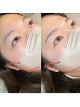 ミモザ アイラッシュ(mimosa eyelash)/お客様デザイン