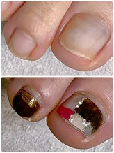 ネイルユー(Nail Yu)/フットケアコース