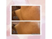 ザ アールアール(THE RR)の雰囲気（ツヤ肌専門店の本気のシミ改善！！）