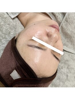 ラ フルール(La Fleur)/カーボキシートリートメント