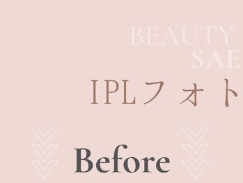 サエラ(SAERA)/フェイシャルビフォーアフター集