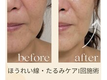 パーソナル ユニ(uni)の雰囲気(完全個室でリラックス/青葉台/毛穴/小顔/美肌/たるみ)