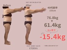 エテルナ(Eterna)