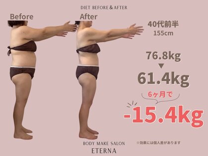 エテルナ(Eterna)の写真