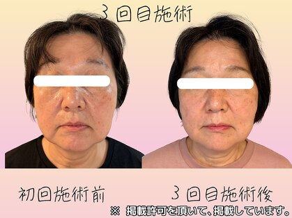 心晴。(コハル)の写真