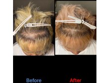 美バリ 新宿店(美BARI)/エアバリで頭皮環境改善