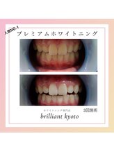 ブリリアント 京都店(Brilliant)/人気！プレミアムホワイトニング