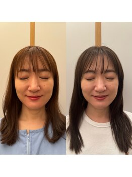 こうぞう整体院/美容鍼×筋膜リリース