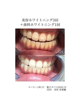 グロウ 東区香椎(GLOW)/美容・歯科ビフォーアフター