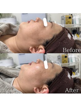 ラ フルール(La Fleur)/カーボキシートリートメント