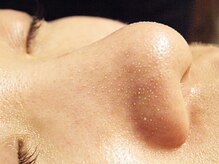 ビュップ 鶴ヶ峰店(美up)の雰囲気（黒ずみ・角質除去ならお任せください♪）