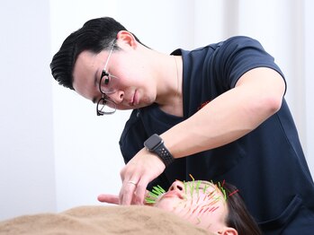 ソラナ(Solana)/美容鍼【100本】百華鍼