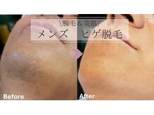 リラクゼーションルーム ココ(CoCo)の雰囲気（男性の脱毛デビューも安心の純国産脱毛機◎）