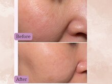 ハナチュチュ 矢場町店(Hanachuchu)/