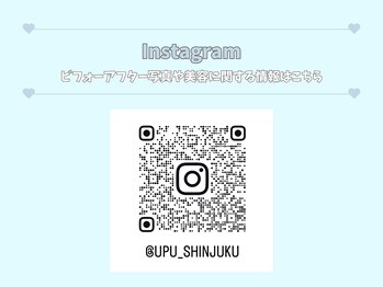 アップユー(UPU)/Instagram