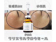 【新登場】敏感肌でもピーリングしたい！DT無しで水光肌に♪