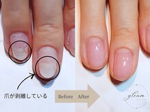 肌と爪は繋がっています。根本から整え美肌、美爪へ導きます