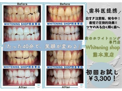 ホワイトニングショップ熊本東店の写真