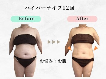 美容整体ウェリナ あま甚目寺院/小顔矯正/骨盤矯正/美脚サロン