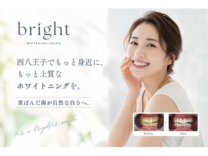 ブライト 八王子(bright)の写真