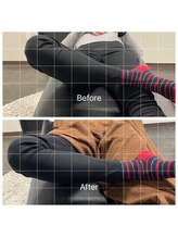 ナオル整体 浅草院(NAORU整体)/40代女性腰痛【開脚の変化】