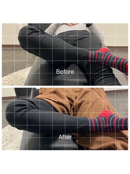 ナオル整体 浅草院(NAORU整体)/40代女性腰痛【開脚の変化】