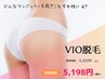 【VIO脱毛】ビキニもランジェリーも着こなす素敵な女性に。初回￥5198♪