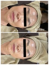 ジャスミン(Jasmin)/エステティック×シェービング