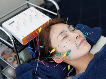 フラット柏(FLAT柏)/【美容鍼】電気で小顔効果UP↑