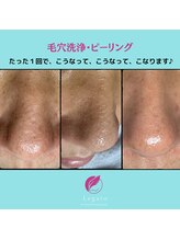 レガート(Legato)/当サロンの毛穴洗浄ピーリング