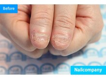ネイルカンパニー/