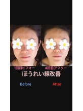 美容矯正サロン レレポノ(LELEPONO)/