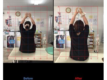 ストレチックス 近江八幡店/ストレッチ ビフォーアフター