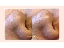 白を基調とした店内/リラクゼーションの空間でプロのケアを！