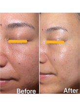 リュミエール デスポワール(Lumiere d'espoir)/白玉ピコ+プラズマ