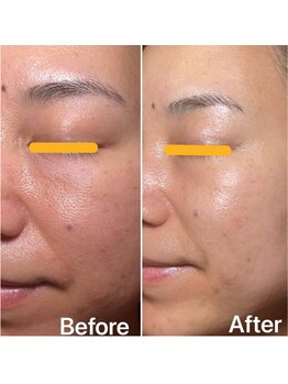 リュミエール デスポワール(Lumiere d'espoir)/白玉ピコ+プラズマ