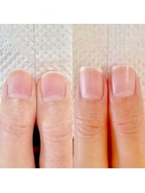 ネイル クリーミー(Nail Creamy)/ネイルケア