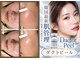 ルーセントの写真