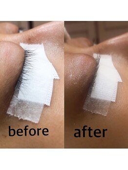 リシェル 沼津(Richelle)/アッパーリフトカール☆