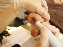 ポドウオーク(PODO WALK)/施術