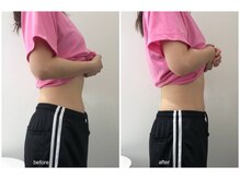 バニーヒップ(Bunny Hip)/before→after