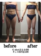 ビーエスアクアビューティー/部分＋全身リンパ