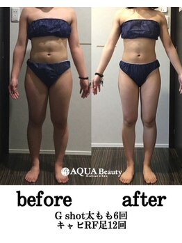 ビーエスアクアビューティー/部分＋全身リンパ