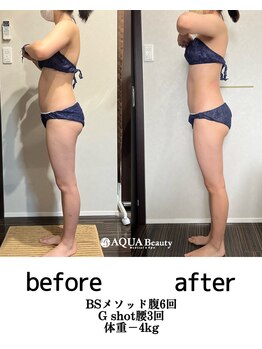 ビーエスアクアビューティー/部分＋全身リンパ