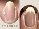 ドライ角質ケア