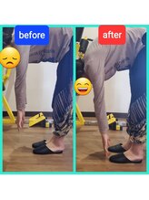 あーる整体院/腰痛の症状